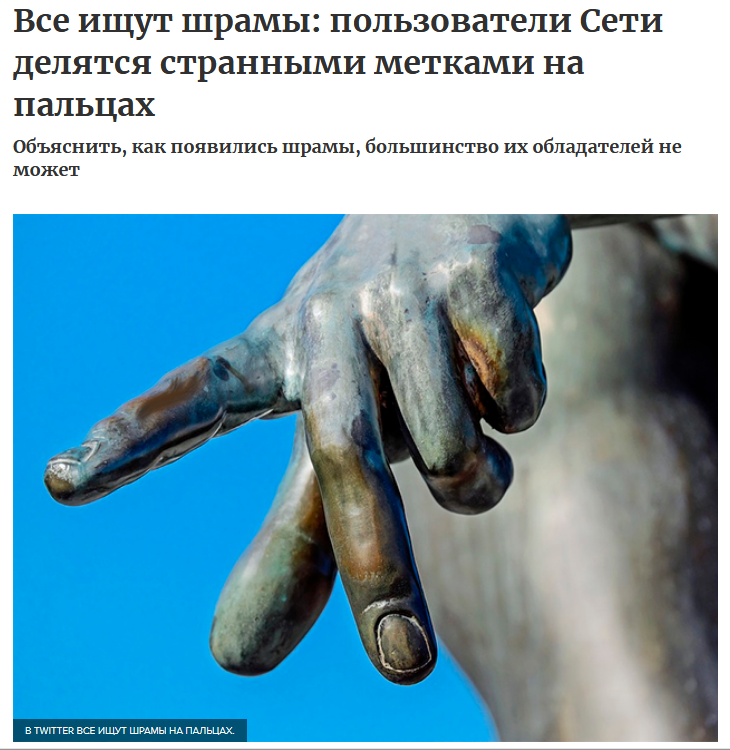 Фотография: Люди вдруг осознали, что у всех них есть шрам на указательном пальце №16 - BigPicture.ru