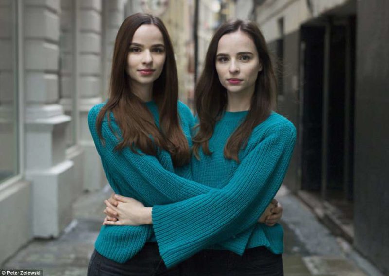 Фотография: Такие похожие, но такие разные: 20 невероятных портретов близнецов №17 - BigPicture.ru