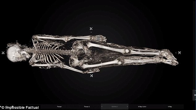 Фотография: Умерла от оспы в 1851 году: установлена личность девушки, погребенной в железном гробу в Нью-Йорке №3 - BigPicture.ru