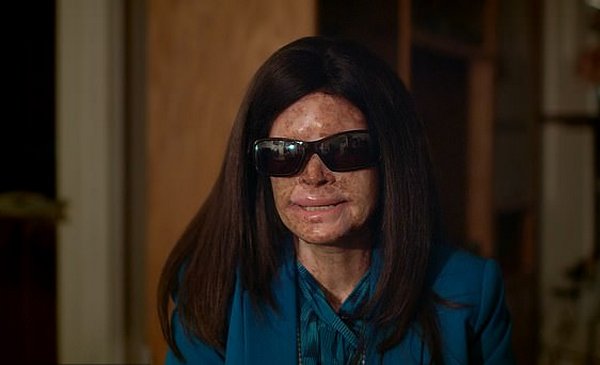 Фотография: Обреченная на заточение: как живет женщина с аллергией на свет №8 - BigPicture.ru