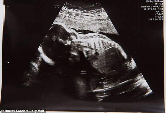 Фотография: 50-летняя британка ожидала двойню, а родила четверню №3 - BigPicture.ru