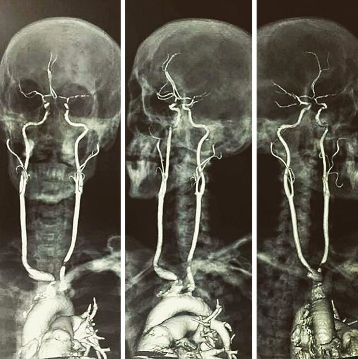 Фотография: Лучше любого учебника: 20+ изображений об анатомии человека, которые вас удивят №15 - BigPicture.ru