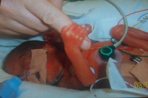 Фотография: Связаны одной судьбой: чудо-близняшки, которые родились с перерывом в 87 дней №4 - BigPicture.ru