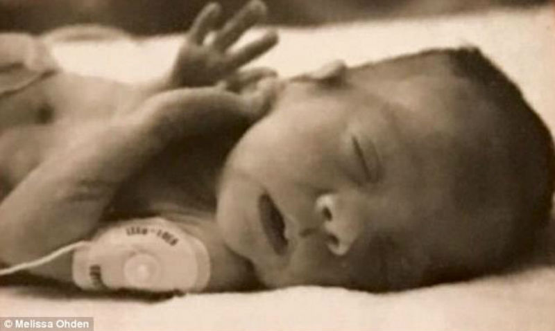 Фотография: Невероятная история Мелиссы Оден, которая выжила после аборта, нашла и простила свою мать №3 - BigPicture.ru