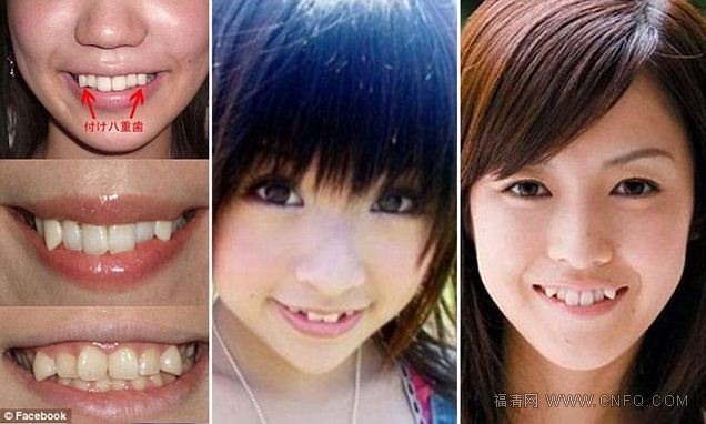 Фотография: Красота кривых зубов, подушки для одиноких и другие удивительные факты о Японии №3 - BigPicture.ru