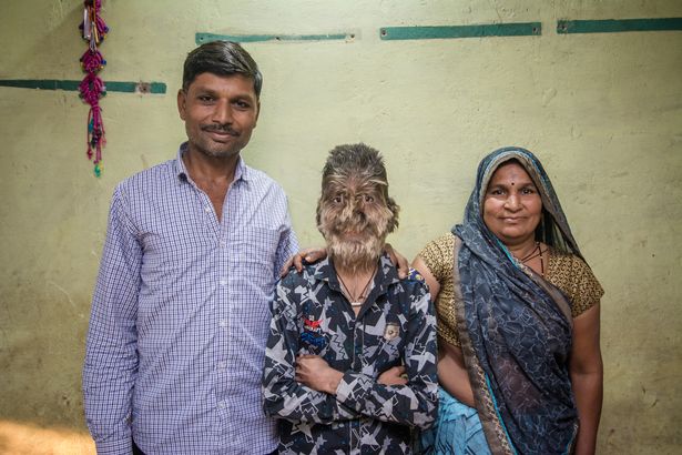 Фотография: Добрый и пушистый: 13-летний мальчик из Индии страдает 