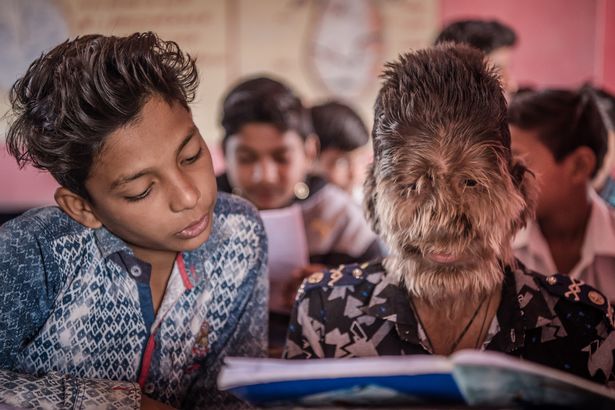 Фотография: Добрый и пушистый: 13-летний мальчик из Индии страдает 