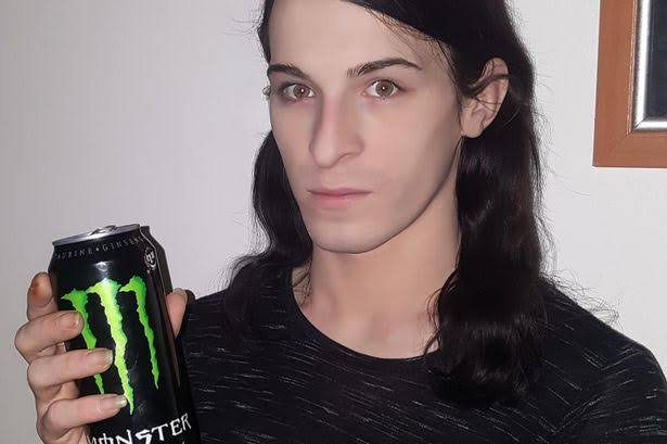Фотография: Энергетик, разрушивший зубы и жизнь: 21-летний парень потерял улыбку и мечты, регулярно употребляя бодрящий напиток №9 - BigPicture.ru