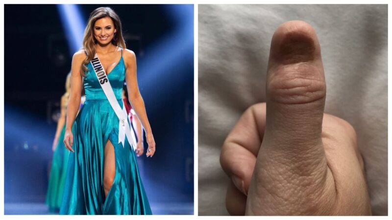 Фотография: Смертельно опасный маникюр: у королевы красоты обнаружили рак после наращивания ногтей №1 - BigPicture.ru