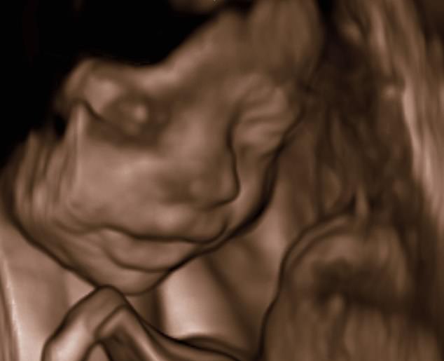 Фотография: Роды в прямом эфире: американка снимала на видео рождение дочери в домашних условиях №9 - BigPicture.ru