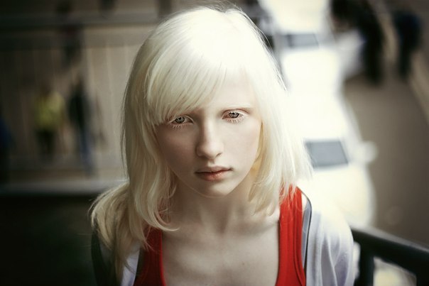 Фотография: Девушка-альбинос, бывшая в московской школе изгоем, покорила мир моды №5 - BigPicture.ru