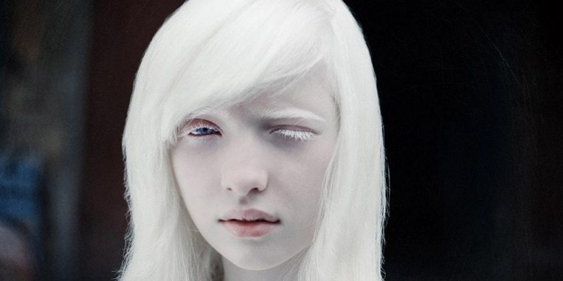 Фотография: Девушка-альбинос, бывшая в московской школе изгоем, покорила мир моды №3 - BigPicture.ru
