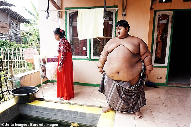 Фотография: Самый толстый мальчик в мире, который весил 192 кг в 10-летнем возрасте, похудел больше, чем вдвое №2 - BigPicture.ru