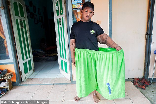 Фотография: Самый толстый мальчик в мире, который весил 192 кг в 10-летнем возрасте, похудел больше, чем вдвое №7 - BigPicture.ru