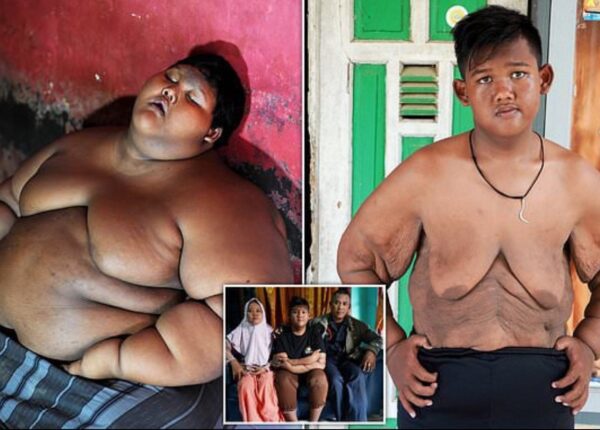 Самый толстый мальчик в мире, который весил 192 кг в 10-летнем возрасте, похудел больше, чем вдвое