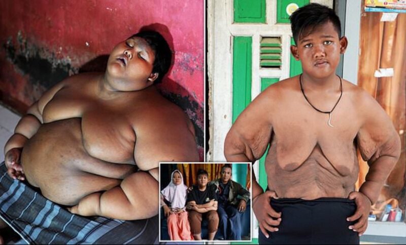 Фотография: Самый толстый мальчик в мире, который весил 192 кг в 10-летнем возрасте, похудел больше, чем вдвое №1 - BigPicture.ru