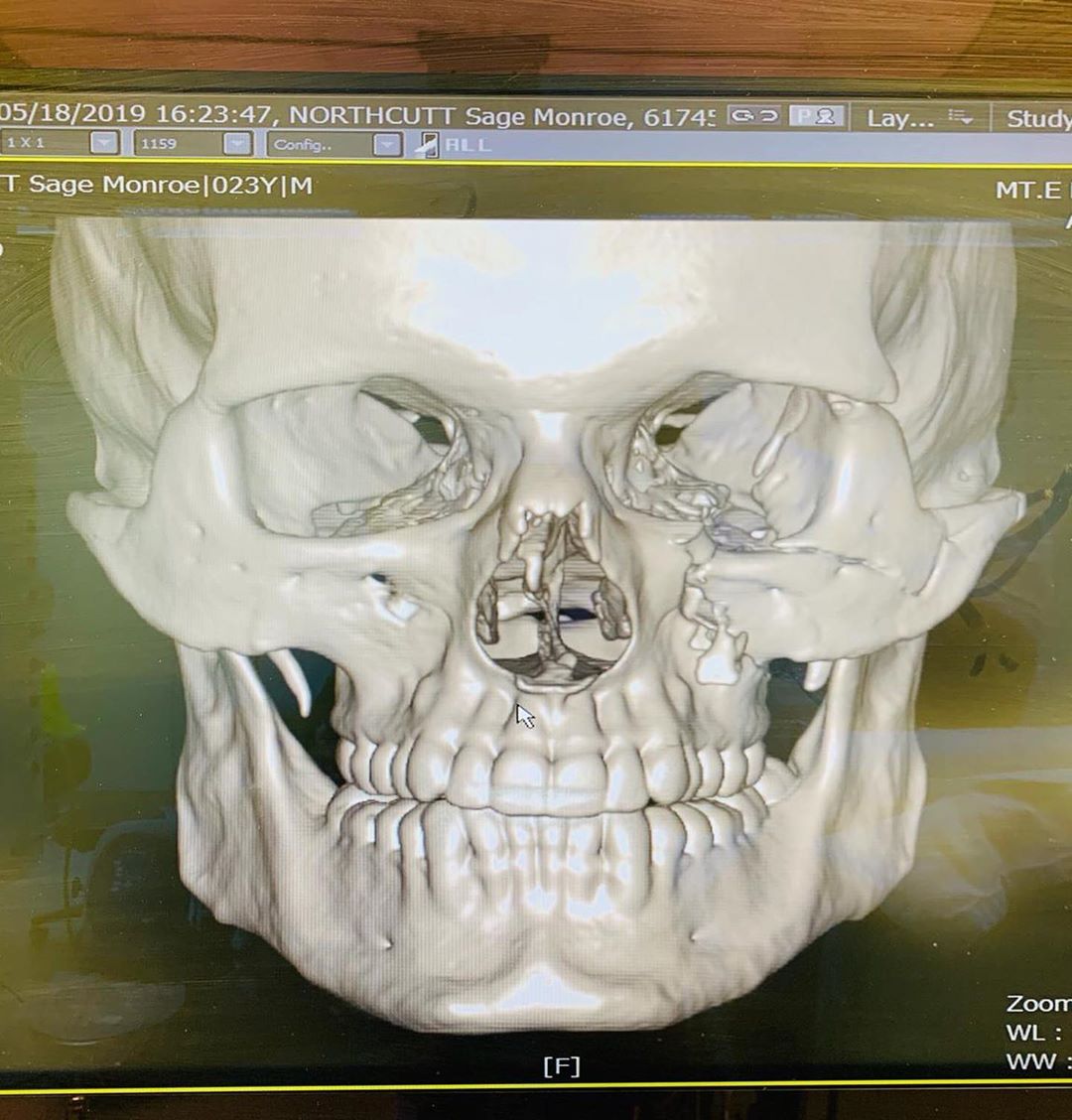 Фотография: Бой длиною в 29 секунд: восемь переломов и череп как у столетней мумии №5 - BigPicture.ru