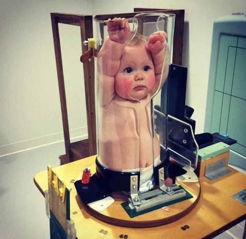 Фотография: Детки в клетке: рентген-аппарат для младенцев вызвал бурные обсуждения в соцсетях №2 - BigPicture.ru