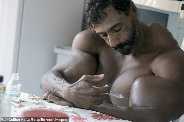 Фотография: Бульбозавр из Бразилии: бывший наркоман делает себе инъекции масла №1 - BigPicture.ru