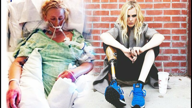 Фотография: Трагическая история Лорен Вассер, которая лишилась ног после использования тампонов №1 - BigPicture.ru