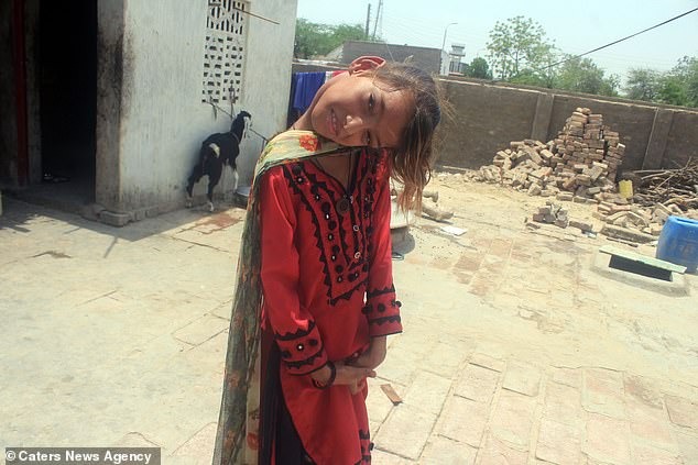 Фотография: Мир под прямым углом: шея 11-летней пакистанки вывернута на 90 градусов №3 - BigPicture.ru
