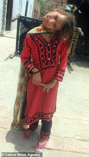 Фотография: Мир под прямым углом: шея 11-летней пакистанки вывернута на 90 градусов №4 - BigPicture.ru