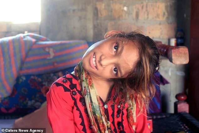 Фотография: Мир под прямым углом: шея 11-летней пакистанки вывернута на 90 градусов №5 - BigPicture.ru