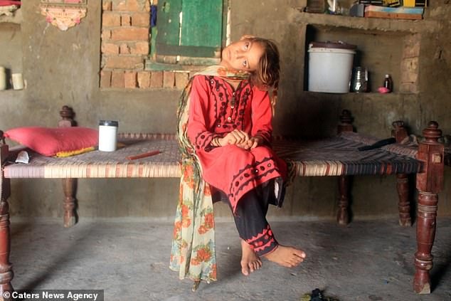 Фотография: Мир под прямым углом: шея 11-летней пакистанки вывернута на 90 градусов №7 - BigPicture.ru