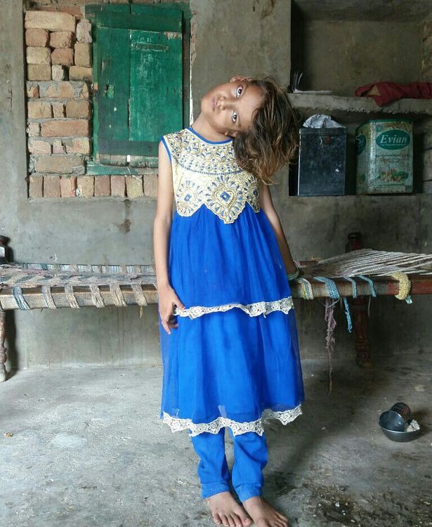 Фотография: Мир под прямым углом: шея 11-летней пакистанки вывернута на 90 градусов №8 - BigPicture.ru