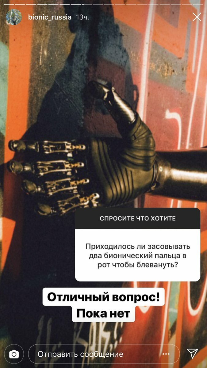 Фотография: Как живется киборгу Косте: откровения парня без рук №5 - BigPicture.ru