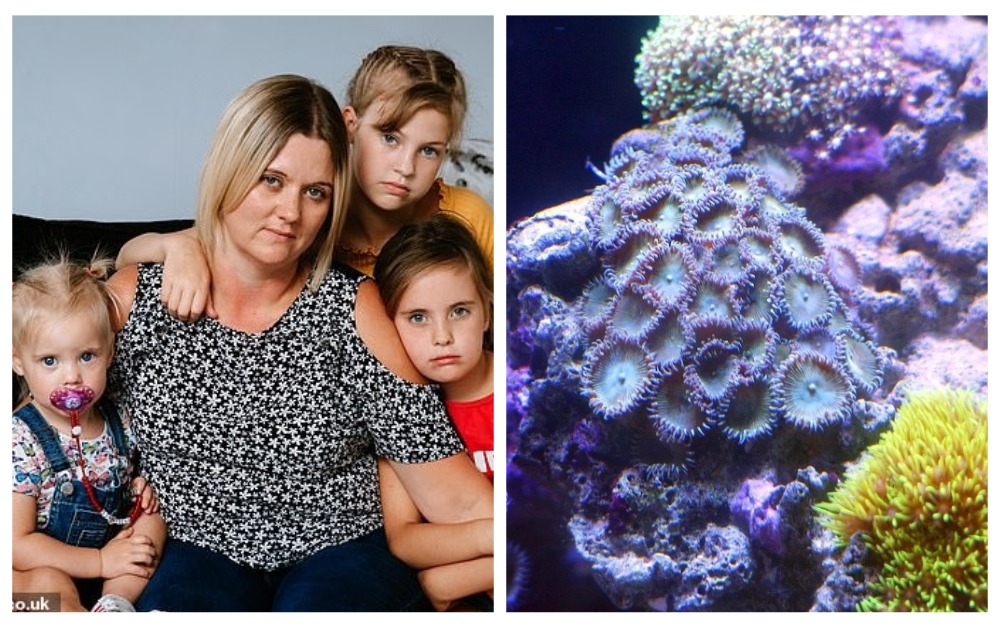 Фотография: Коралл-убийца: мать четверых детей чуть не умерла от отравления после чистки аквариума №1 - BigPicture.ru