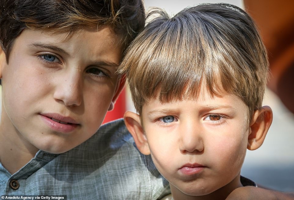 Фотография: Разноцветные гены: братья из Турции с редкой гетерохромией завораживают с первого взгляда №2 - BigPicture.ru