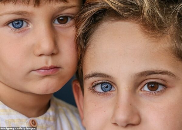 Разноцветные гены: братья из Турции с редкой гетерохромией завораживают с первого взгляда