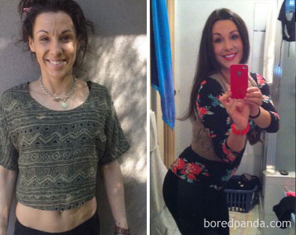 Фотография: До и после: 20 фото людей, которые решили завязать с наркотиками №18 - BigPicture.ru