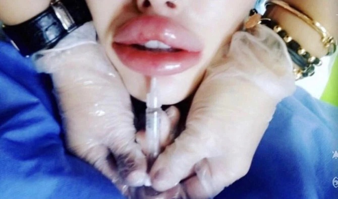 Фотография: Фетиш-модель чуть не умерла во время пластической операции на вагине №3 - BigPicture.ru