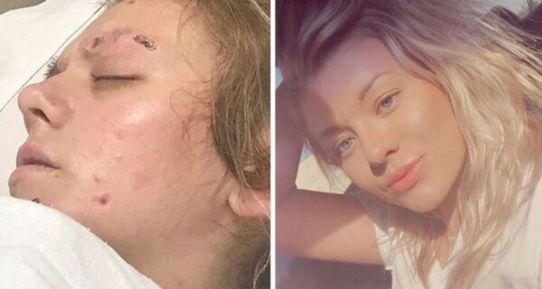 До и после: 20 фото людей, которые решили завязать с наркотиками