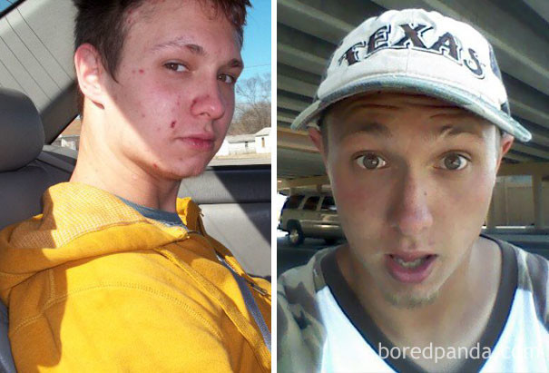 Фотография: До и после: 20 фото людей, которые решили завязать с наркотиками №17 - BigPicture.ru