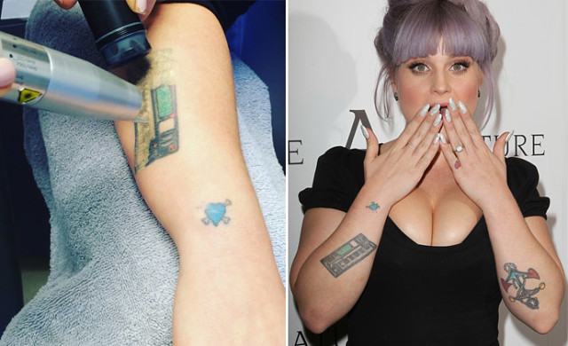 Сводить или не сводить: 8 знаменитостей, которые пожалели о своих татуировках