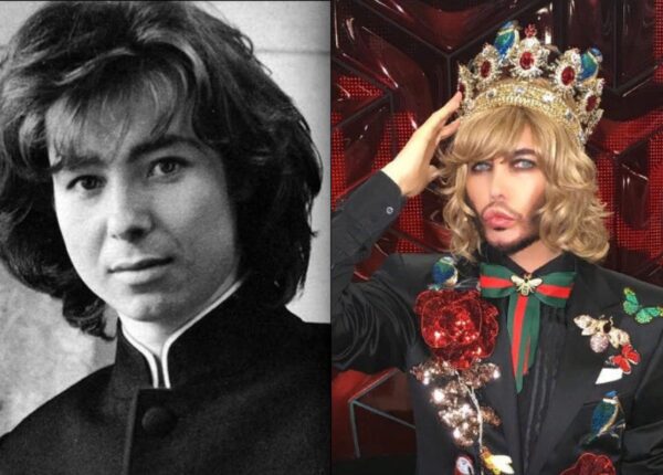 10 российских звезд, кардинально изменивших внешность за время своей карьеры