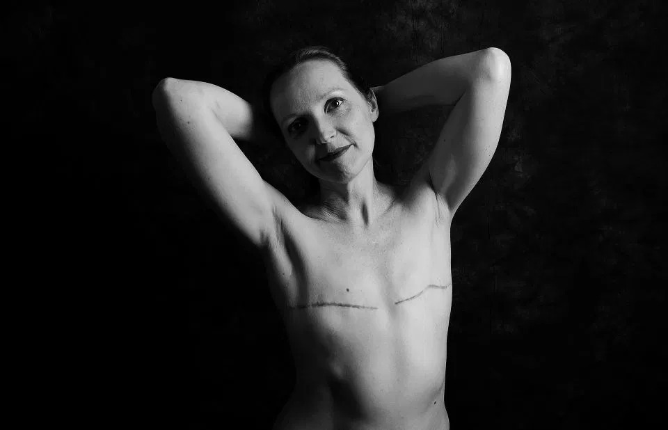 Фотография: Голая правда: смелые пациенты противостоят раку, демонстрируя шрамы в пронзительном фотопроекте Ами Барвелл №3 - BigPicture.ru