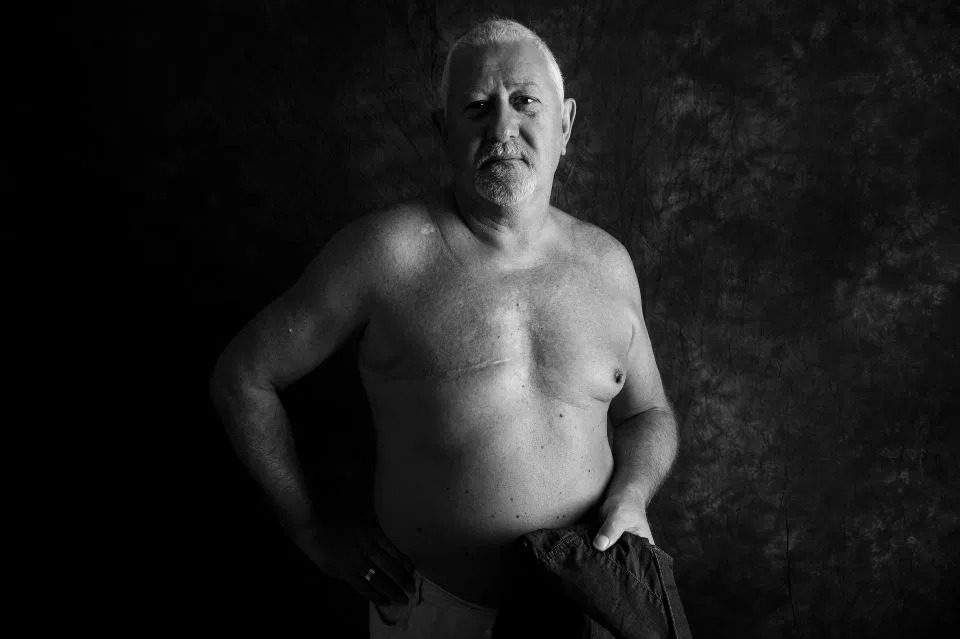 Фотография: Голая правда: смелые пациенты противостоят раку, демонстрируя шрамы в пронзительном фотопроекте Ами Барвелл №9 - BigPicture.ru