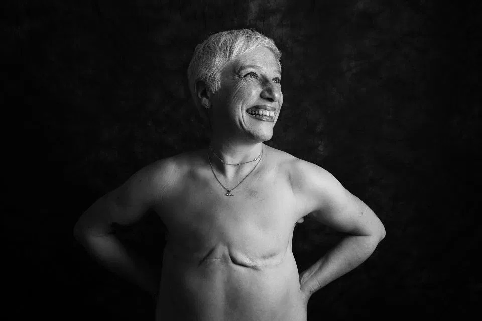 Фотография: Голая правда: смелые пациенты противостоят раку, демонстрируя шрамы в пронзительном фотопроекте Ами Барвелл №11 - BigPicture.ru