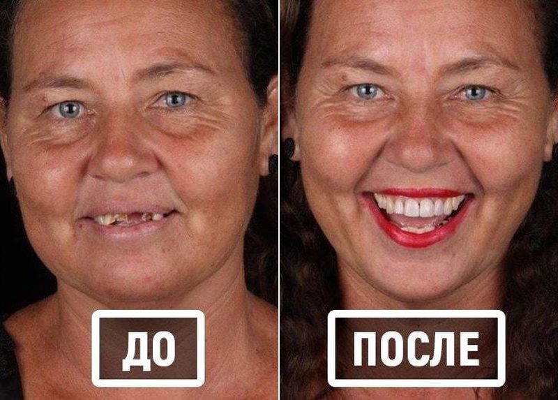Фотография: Бразильский стоматолог помогает беднякам блистать белоснежной улыбкой №1 - BigPicture.ru