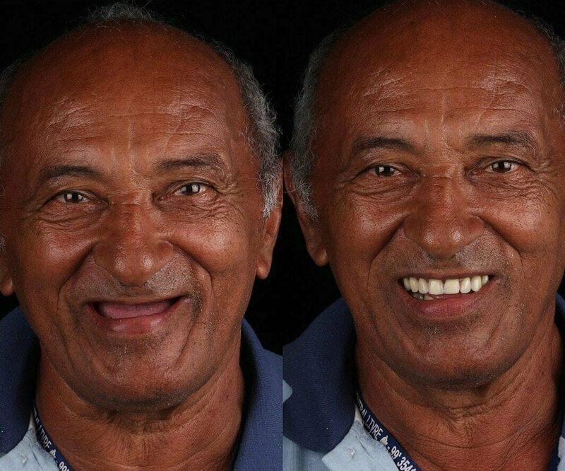 Фотография: Бразильский стоматолог помогает беднякам блистать белоснежной улыбкой №2 - BigPicture.ru