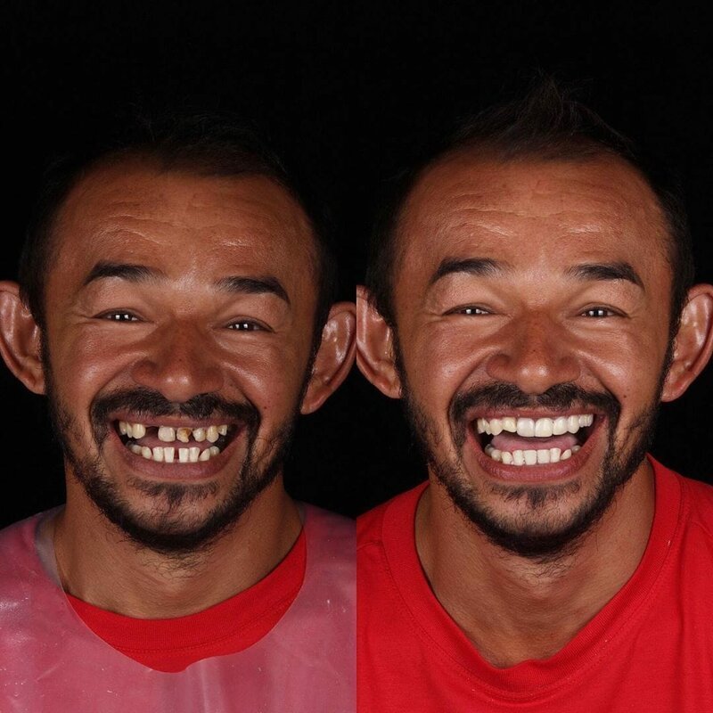 Фотография: Бразильский стоматолог помогает беднякам блистать белоснежной улыбкой №3 - BigPicture.ru