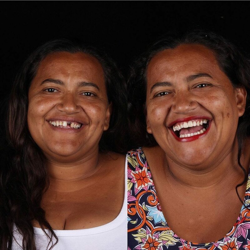 Фотография: Бразильский стоматолог помогает беднякам блистать белоснежной улыбкой №4 - BigPicture.ru