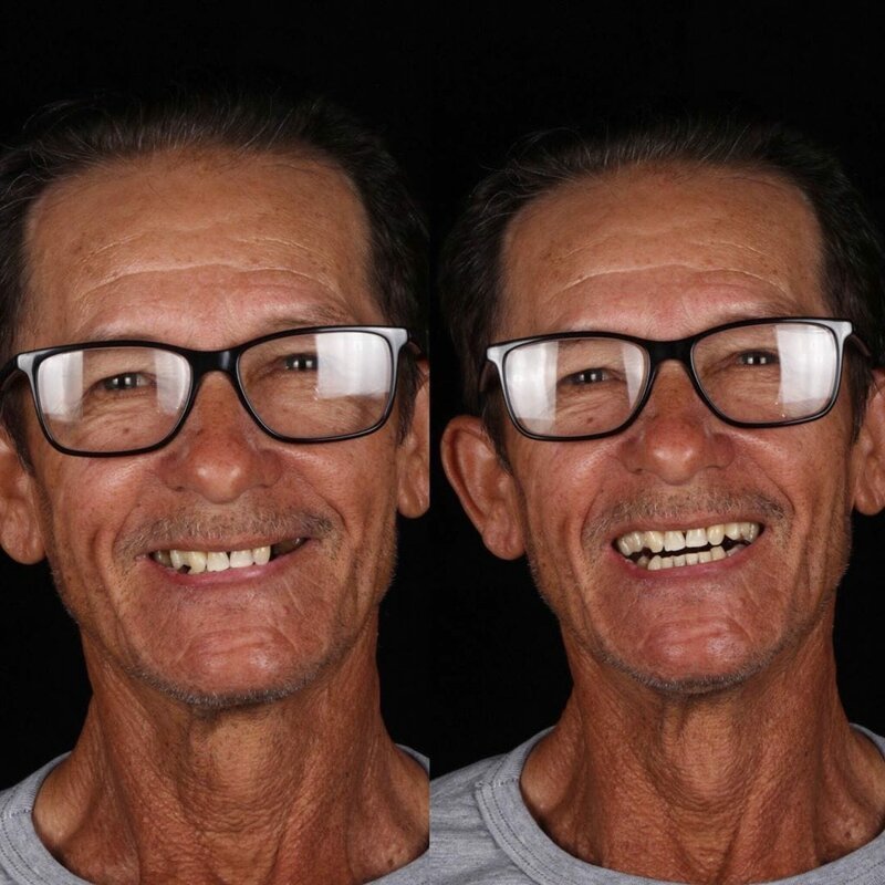 Фотография: Бразильский стоматолог помогает беднякам блистать белоснежной улыбкой №5 - BigPicture.ru