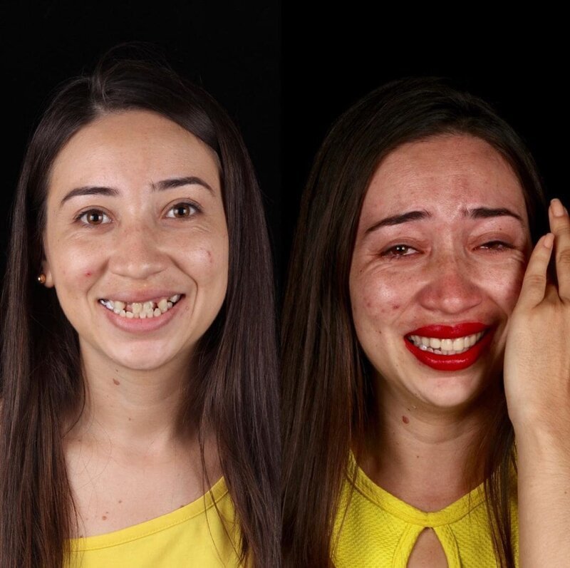 Фотография: Бразильский стоматолог помогает беднякам блистать белоснежной улыбкой №6 - BigPicture.ru