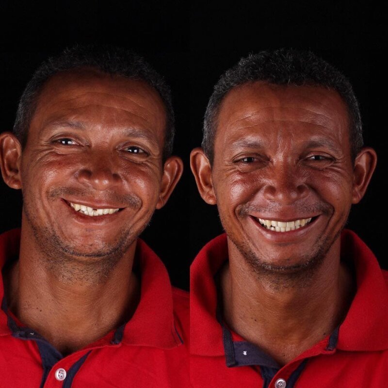Фотография: Бразильский стоматолог помогает беднякам блистать белоснежной улыбкой №8 - BigPicture.ru