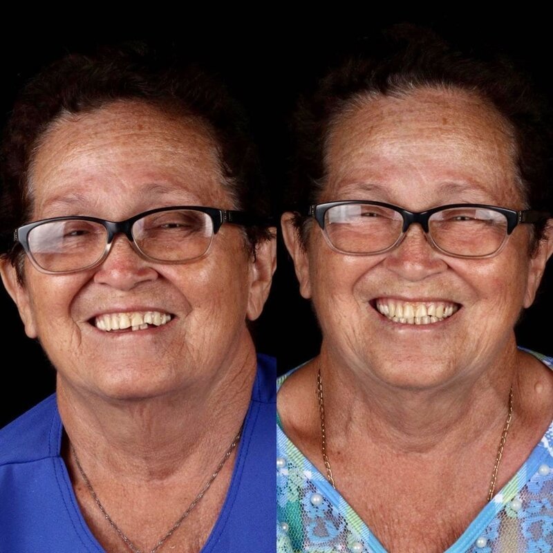 Фотография: Бразильский стоматолог помогает беднякам блистать белоснежной улыбкой №9 - BigPicture.ru